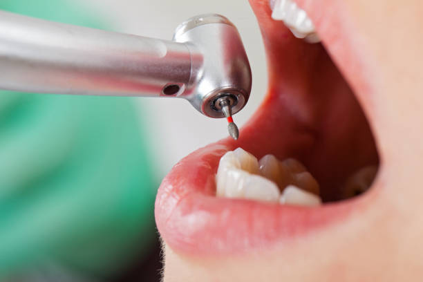 Best Emergency Gum Treatment in South Laurel, MD
